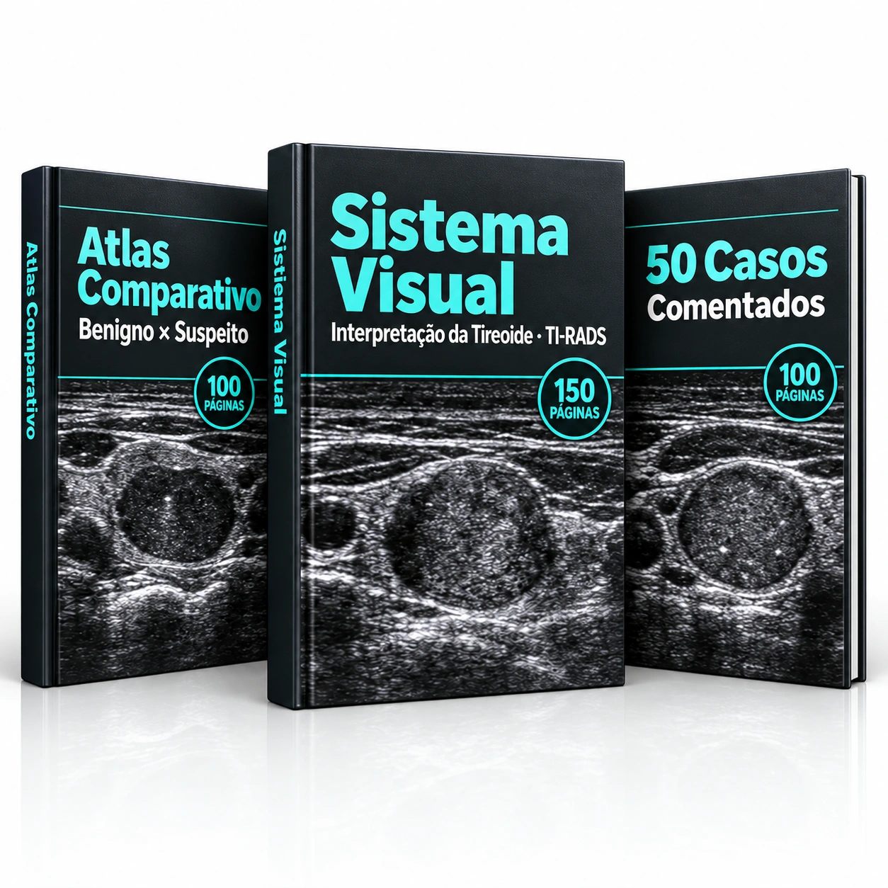 Tireoide Visual: Sistema Visual, Atlas Comparativo e 50 Casos Comentados