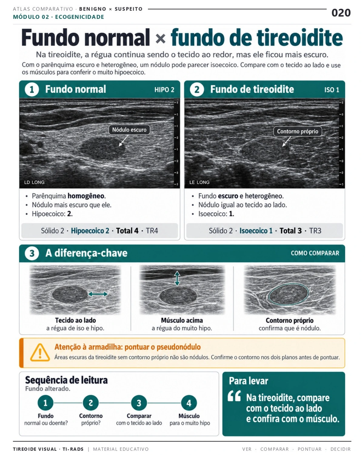 Página 20: Fundo normal × fundo de tireoidite. Prévia do PDF Tireoide Visual TI-RADS; imagens didáticas simuladas.