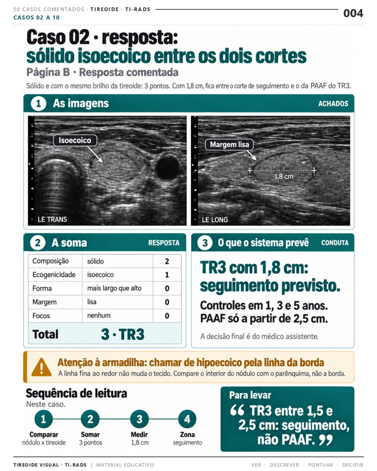 Página 4: Caso 02: resposta comentada. Prévia do PDF Tireoide Visual TI-RADS; imagens didáticas simuladas.