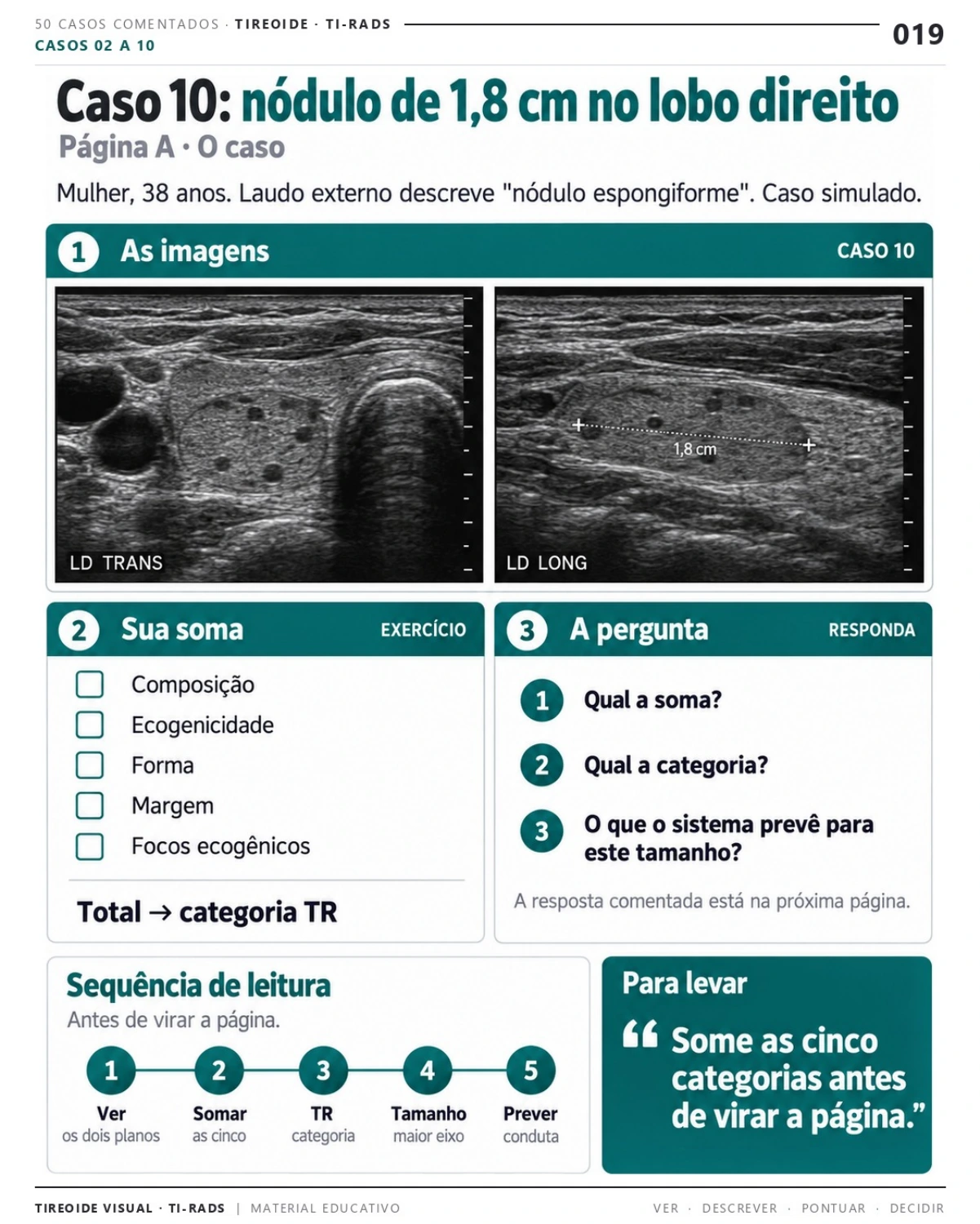 Página 19: Caso 10: nódulo de 1,8 cm no lobo direito. Prévia do PDF Tireoide Visual TI-RADS; imagens didáticas simuladas.